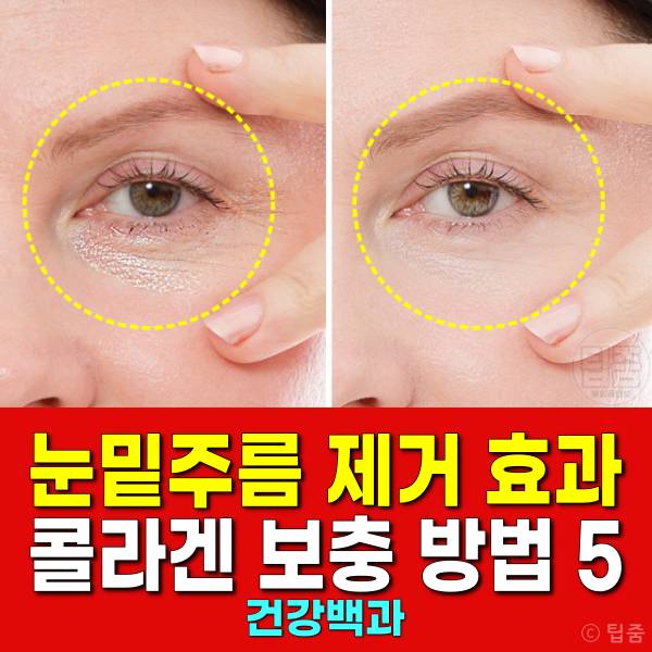 눈밑주름 제거 콜라겐 부족 보충