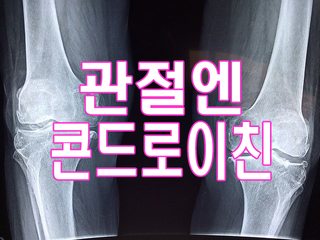 관절-뼈-엑스레이-사진