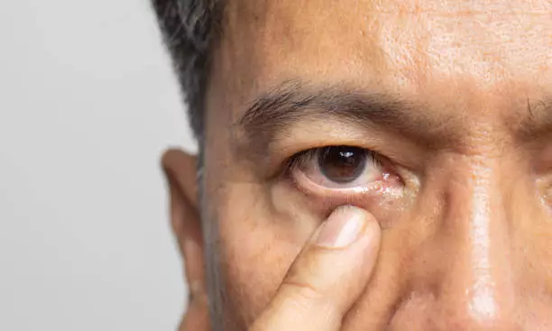 눈밑 주름 없애는 방법 9가지