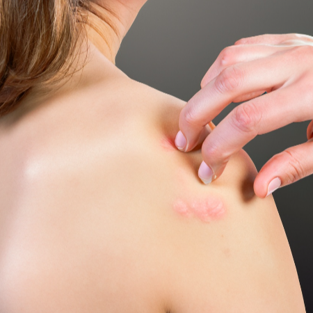 2. 적절한 습도 관리