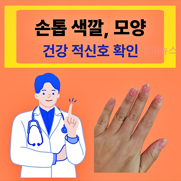 손톱 모양, 색깔로 확인하는 건강 적신호