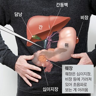 췌장 위치