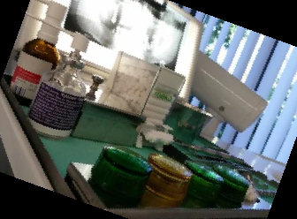 임플란트 가격 종류 비용