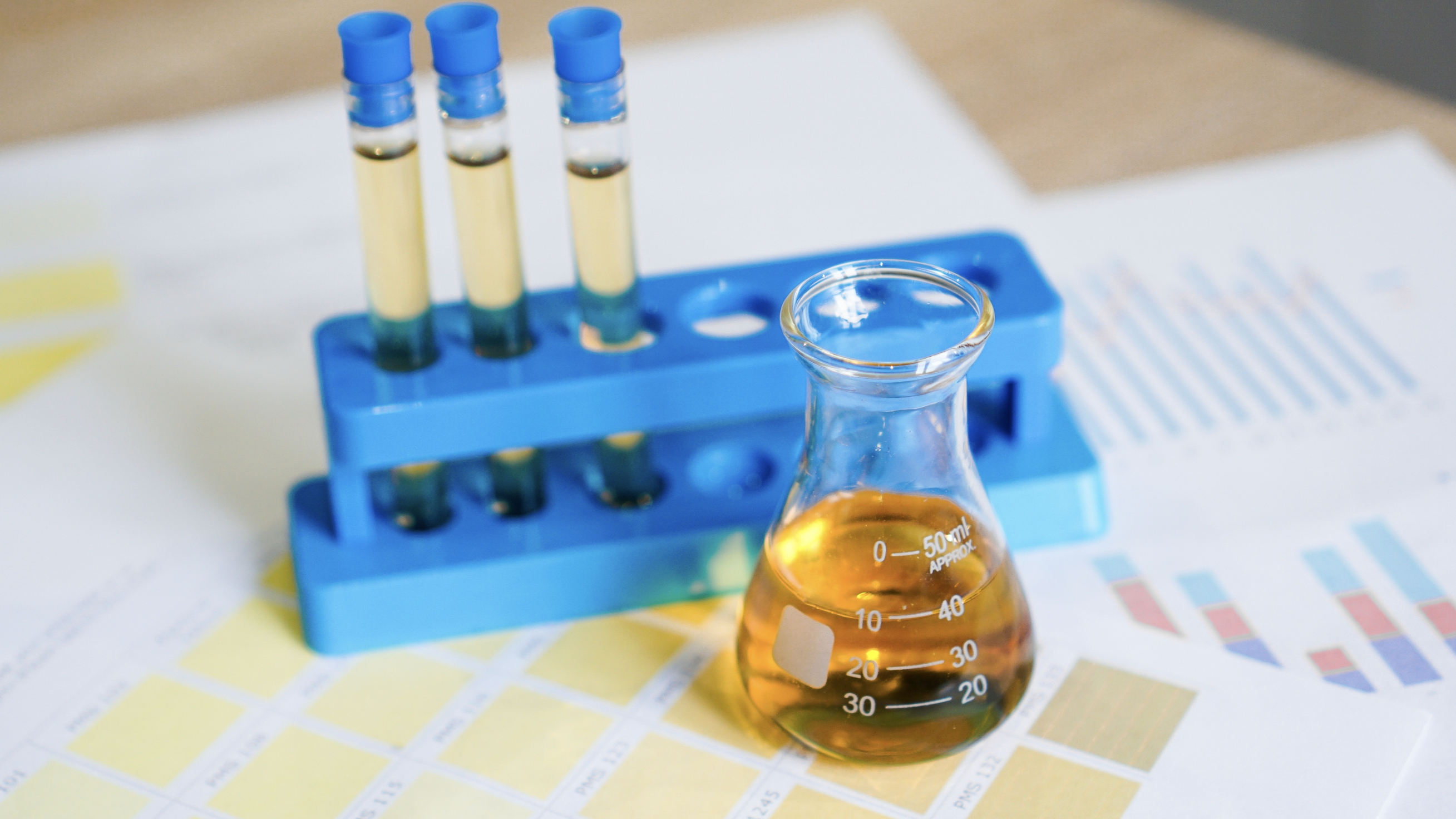 소변 검사 (Urinalysis)