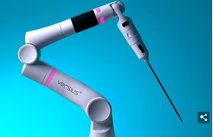 영국 첫 암 로봇 수술 성공 VIDEO: Versius robot aims for 'minimal access' in life-saving surgery