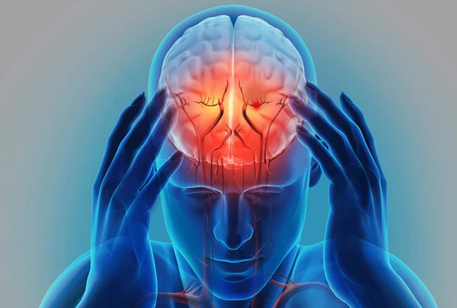 뇌졸중 전조증상