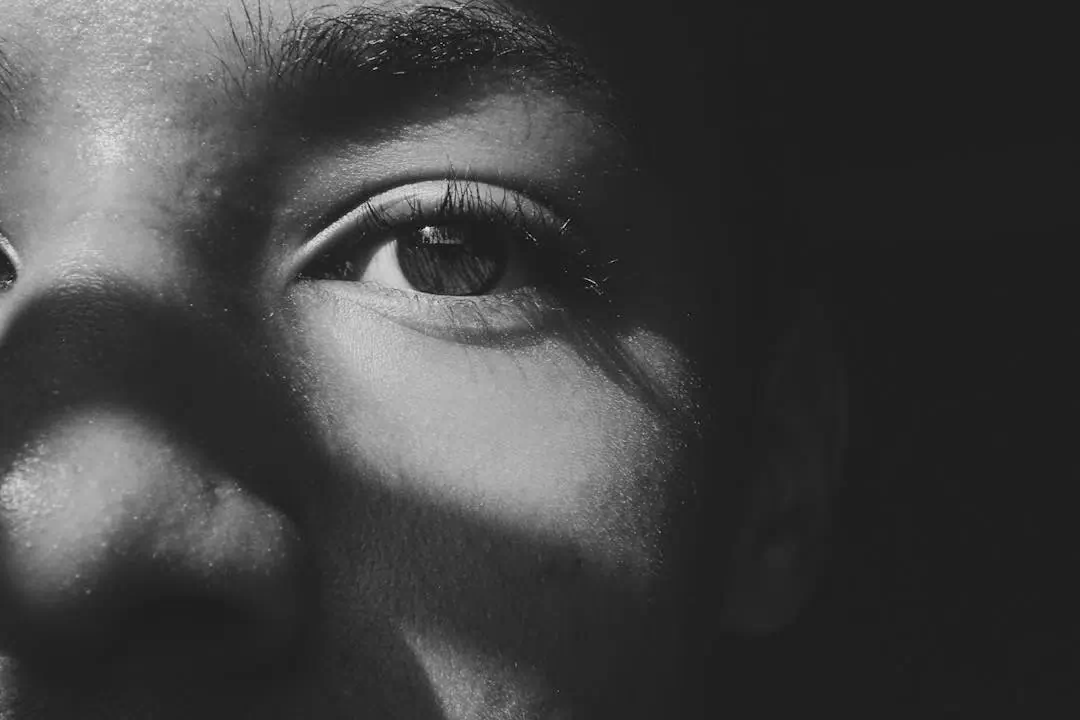 백내장 관련사진9