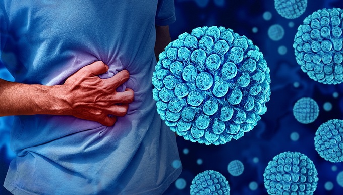 노로바이러스 감염을 예방하기-조개류 요리법-환자