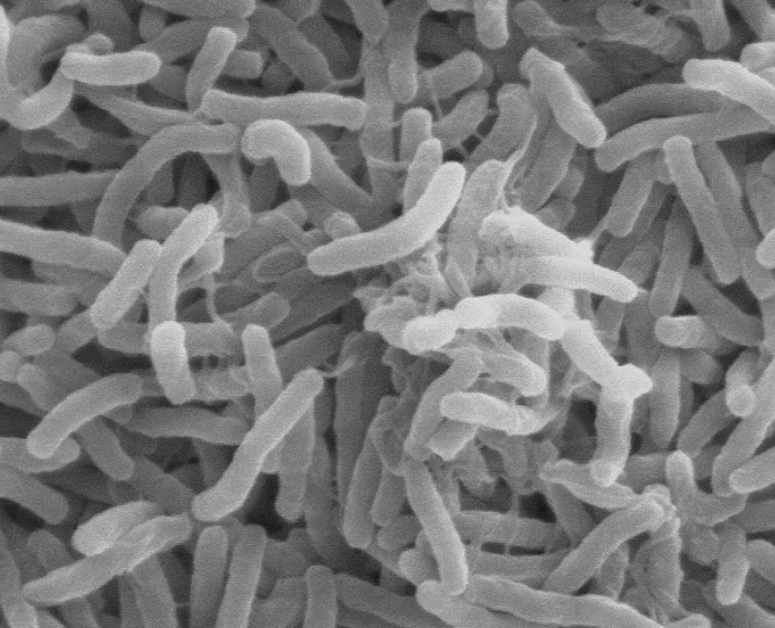 [감염병 주의] 콜레라 증상 및 감염 경로, 예방 방법