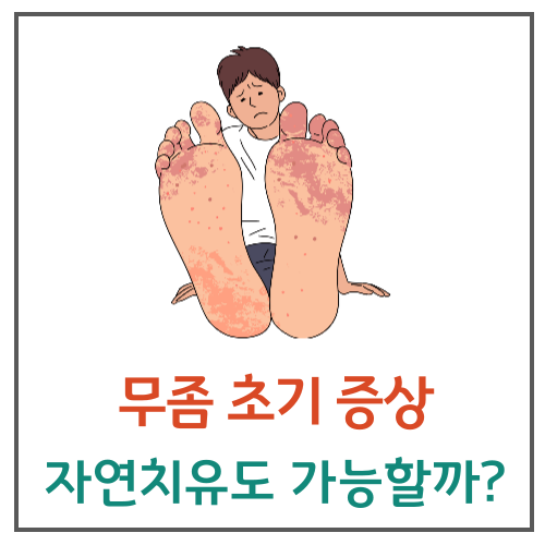 무좀 초기증상, 자연치유