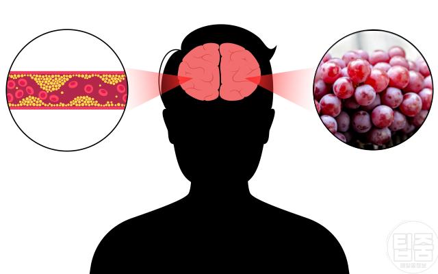 포도 뇌혈관 동맥경화