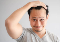 탈모로 고민하는 사람들 이미지