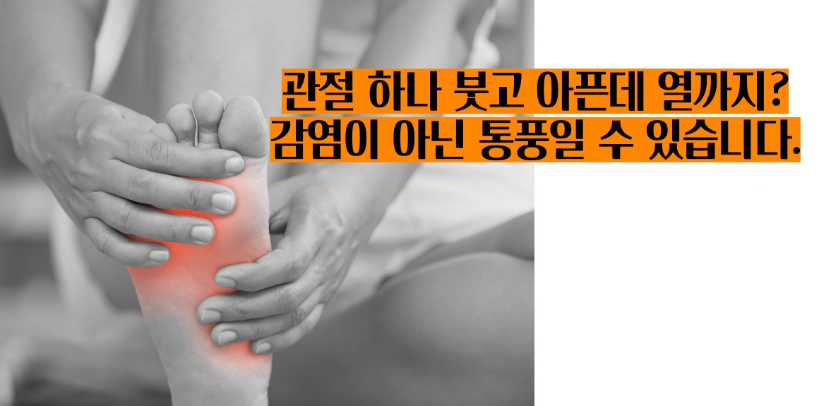급성 통풍