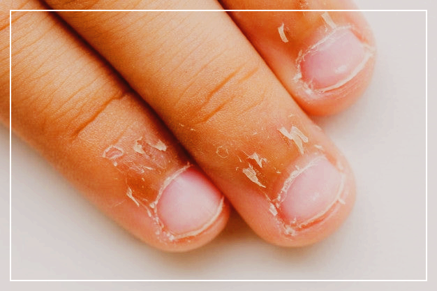 손 까시래기 거스러미