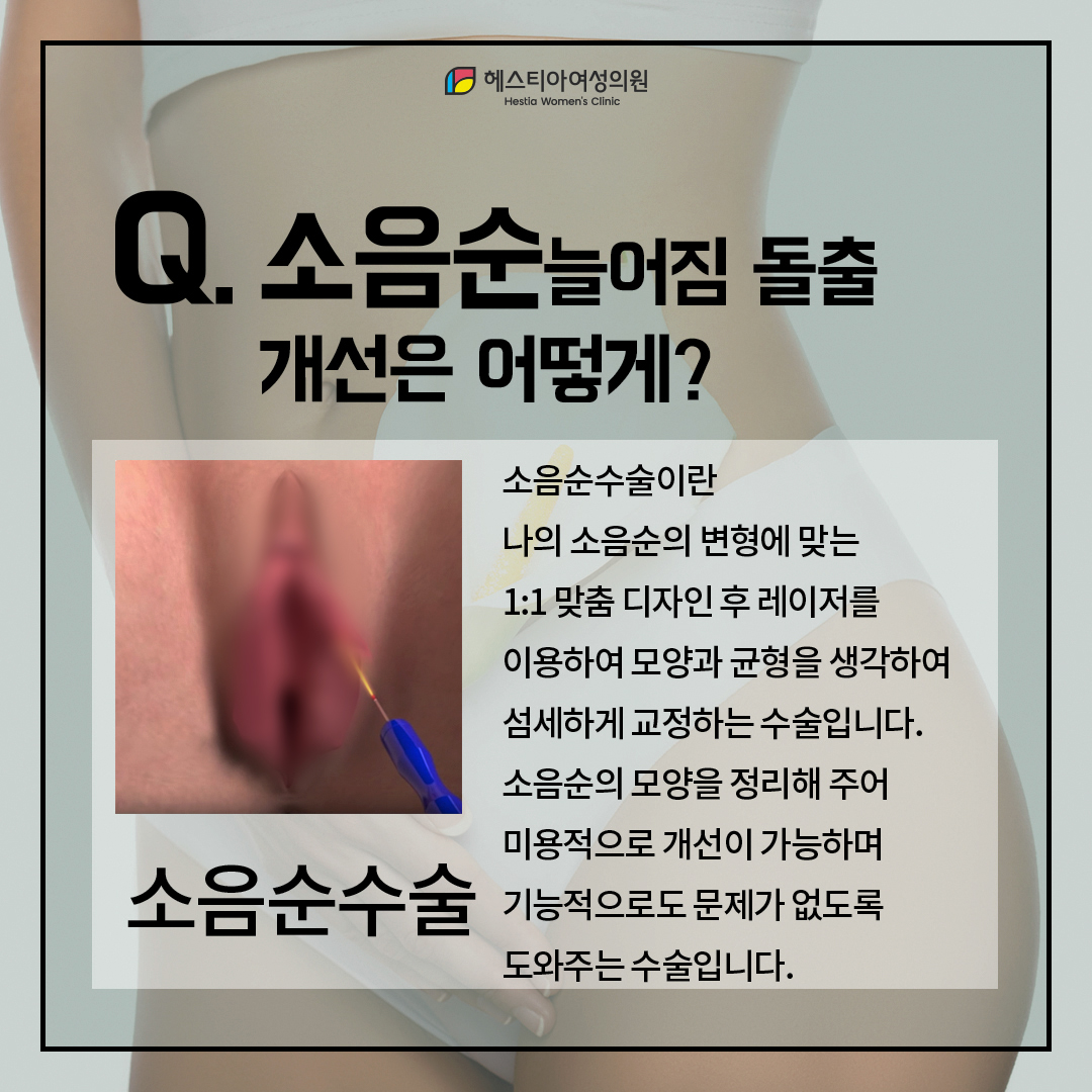 소음순늘어짐 돌출 개선은 어떻게 하나요?