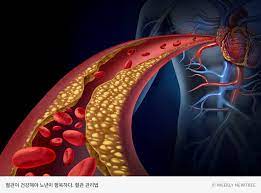 서리태 효능 5가지 검정콩 효능 부작용