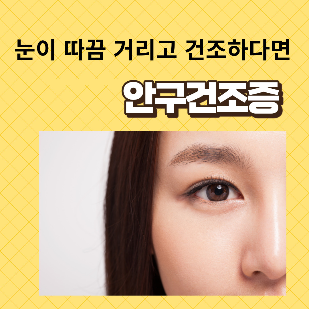 안구건조증