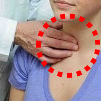 식도암-검사하는-사진