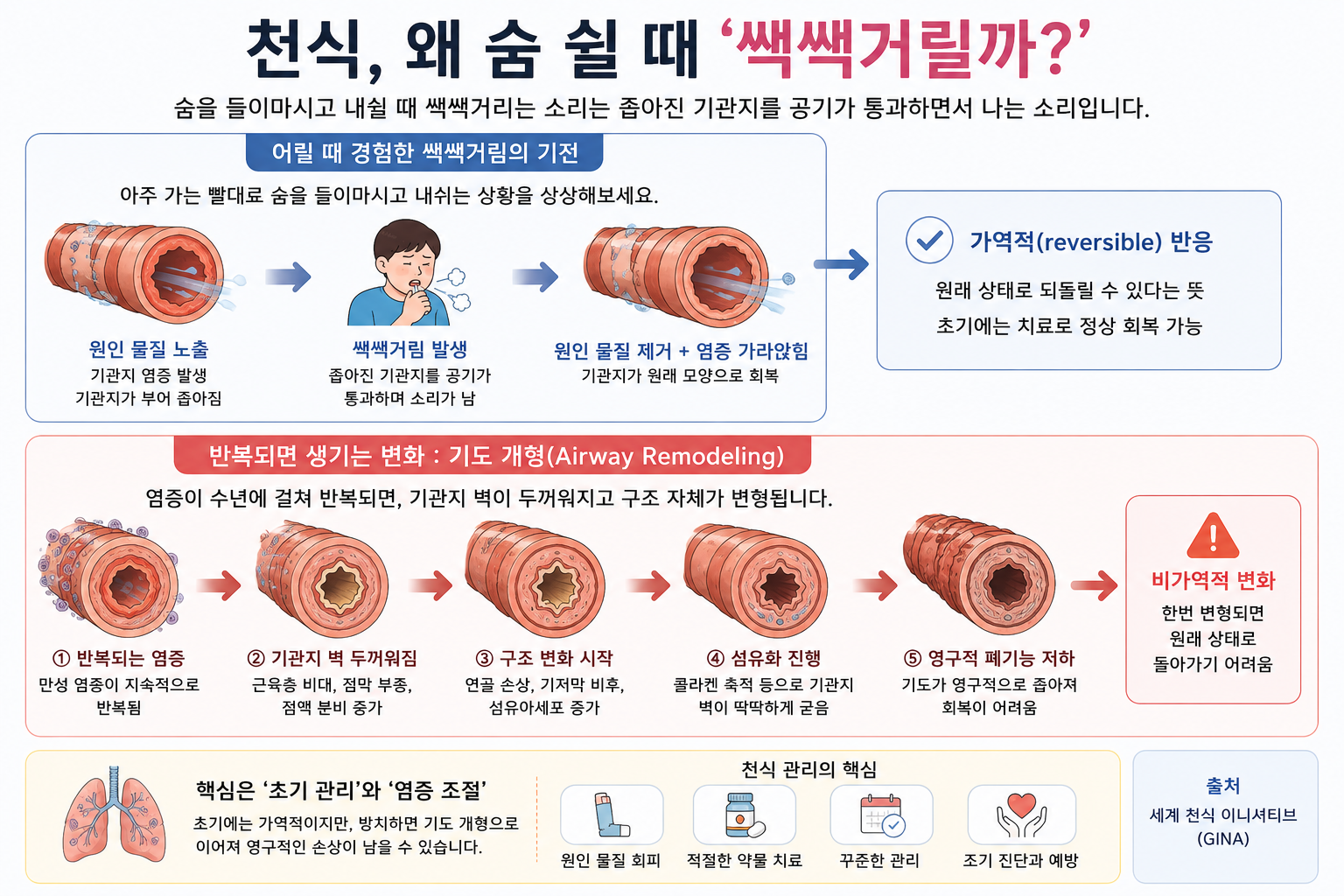 천식의 가역적 반응