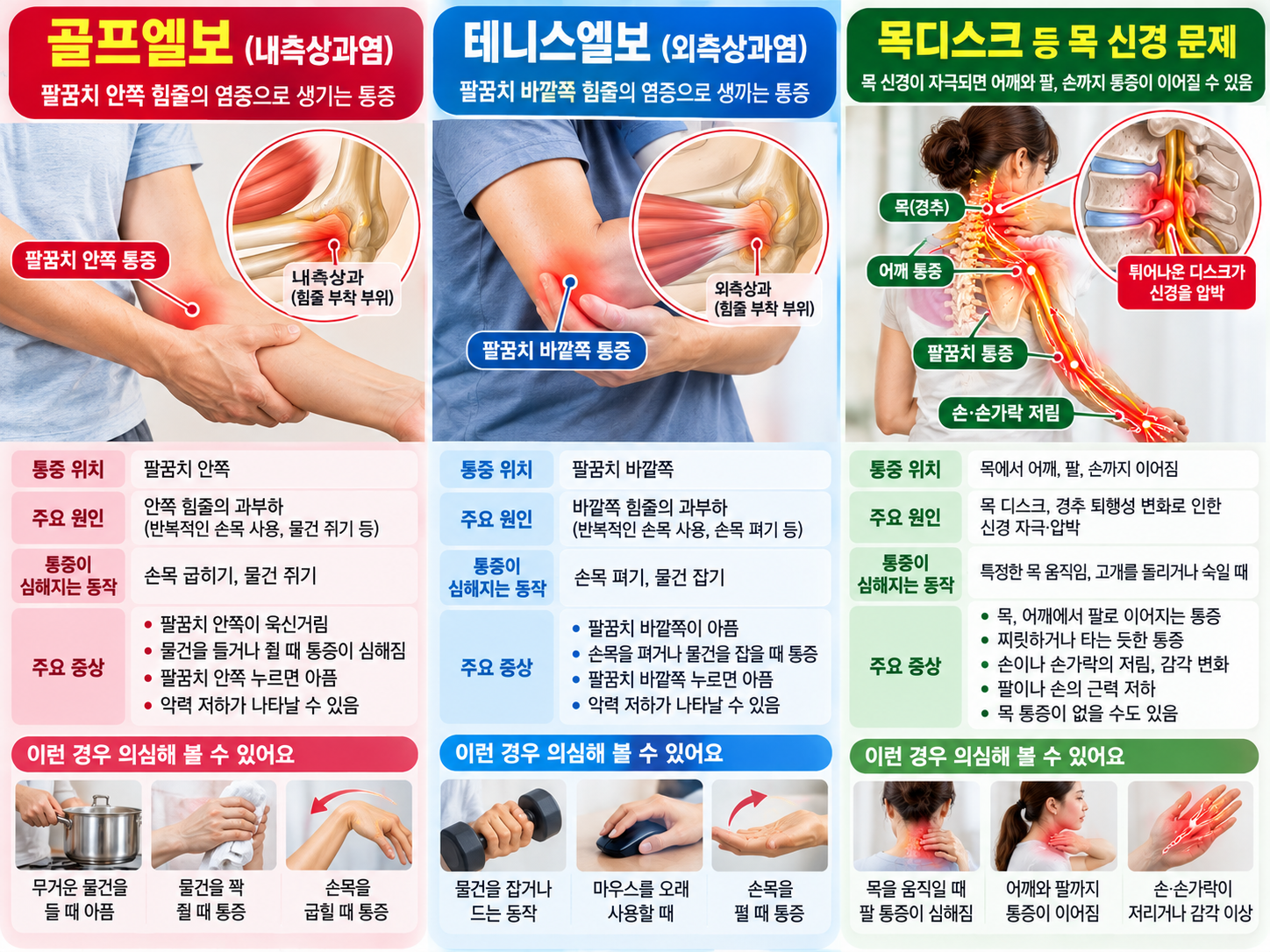 골프엘보는 팔꿈치 안쪽, 테니스엘보는 바깥쪽, 목 신경 문제는 목에서 팔로 이어지는 통증 경로를 비교한 인포그래픽