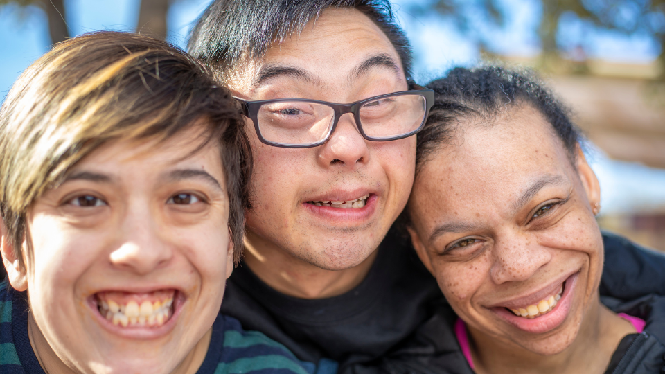 지적 장애의 대표 증상인 다운증후군