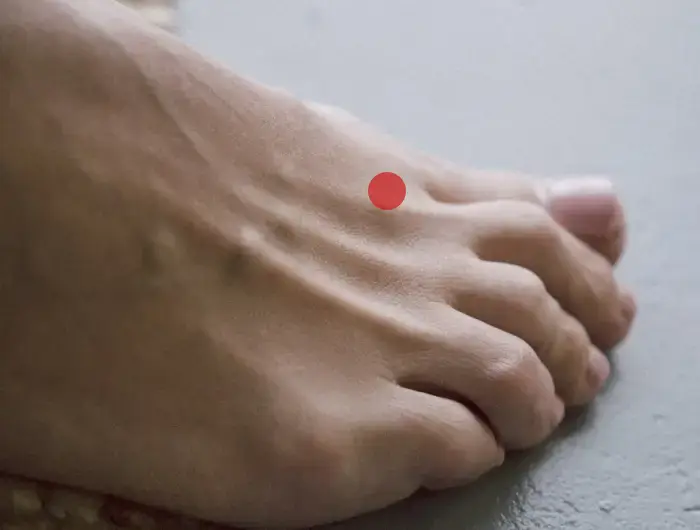 체했을 때 지압