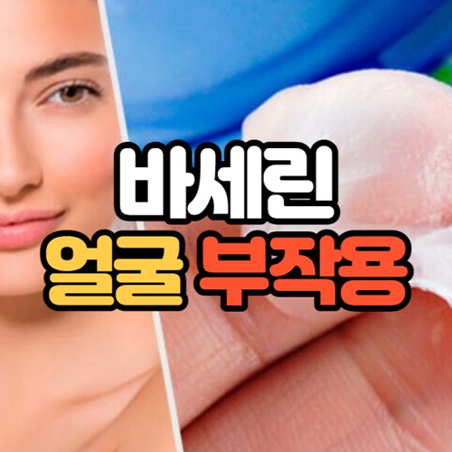 바세린 얼굴