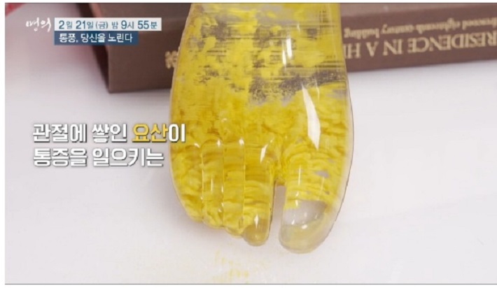 통풍명의
