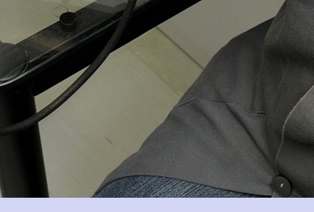 대상포진 치료기간