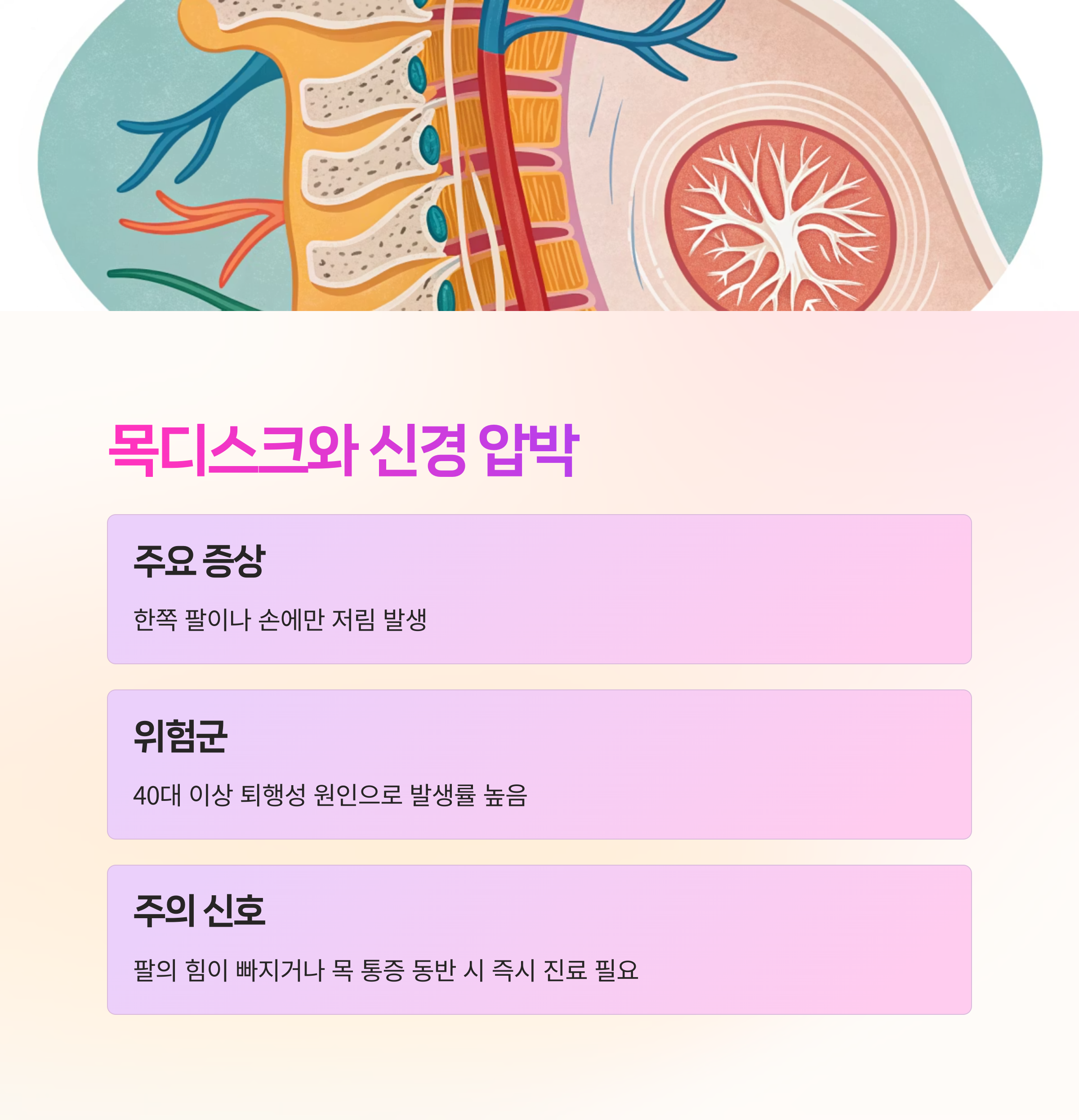 목디스크와 신경 압박