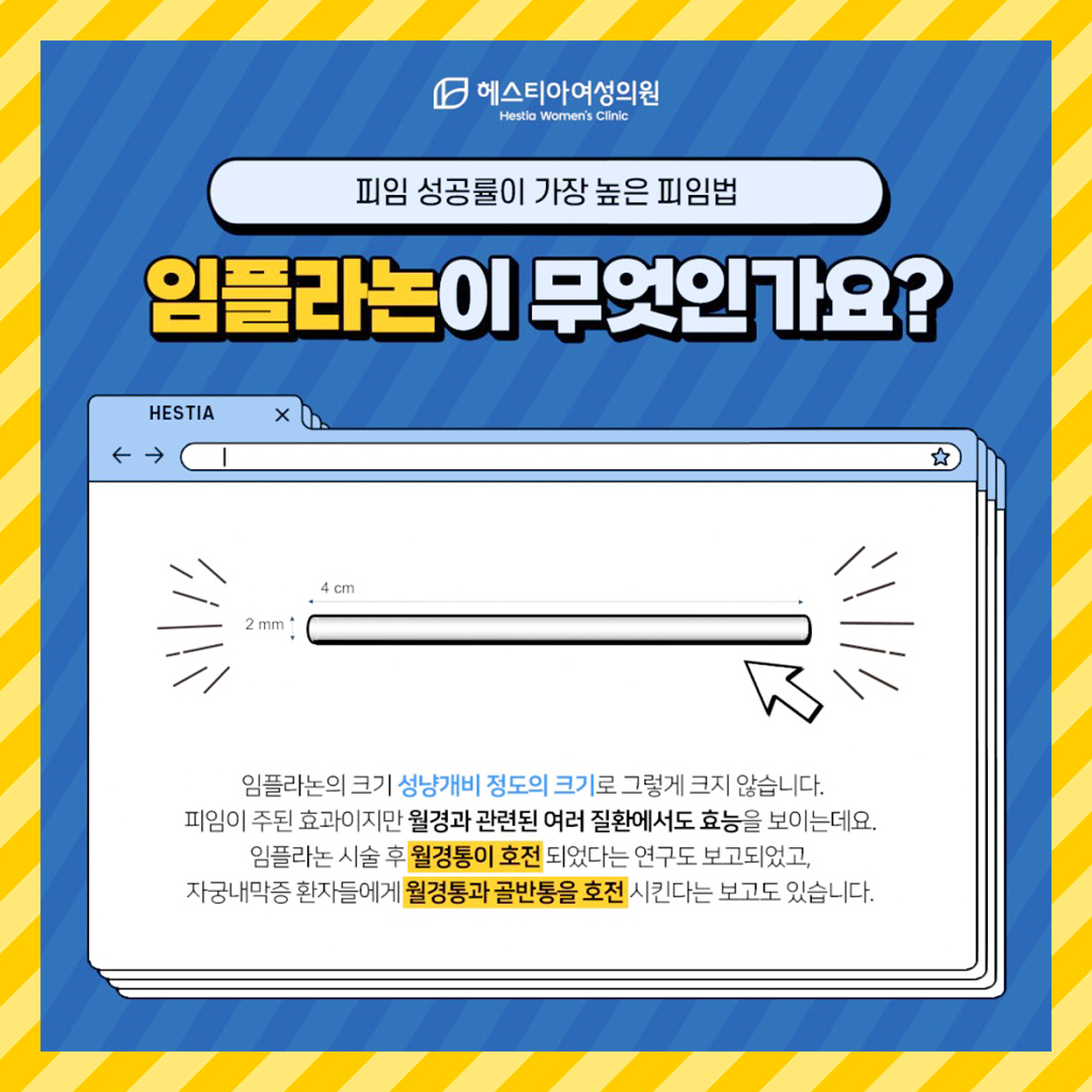 임플라논이 무엇인가요?