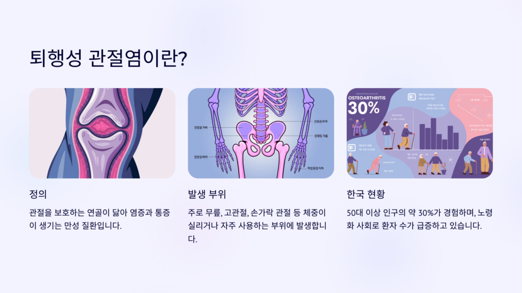 퇴행성 관절염이란?