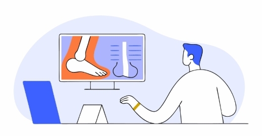 무지외반증 수술 과정