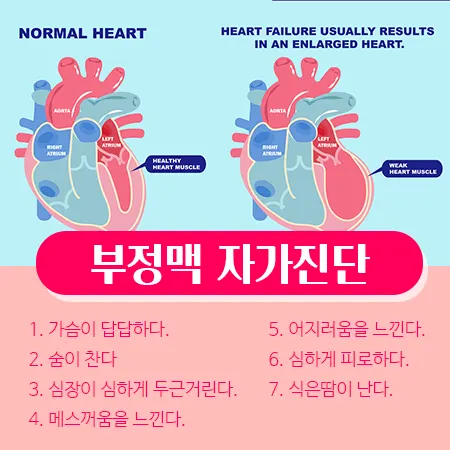 부정맥 증상