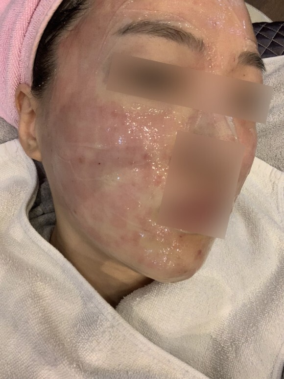 크라이오셀 후기