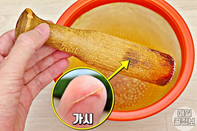 손가락 가시 응급처치법