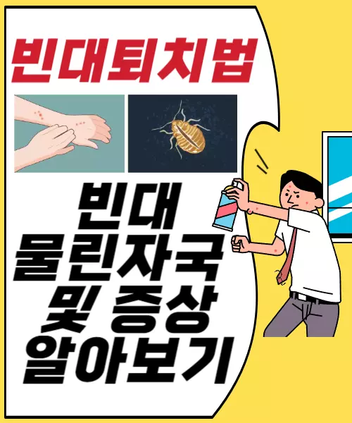 빈대퇴치법