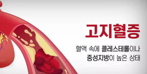 고지혈증-정의