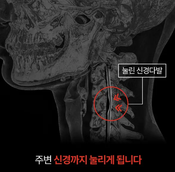 목건강 통증