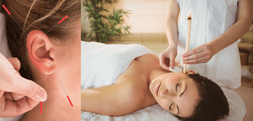 피부미용 - 이어테라피(정의, 유래, 효과, 반사요법)