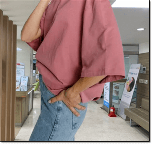 고관정 통증이 있는 여성