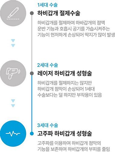 비중격만곡증수술