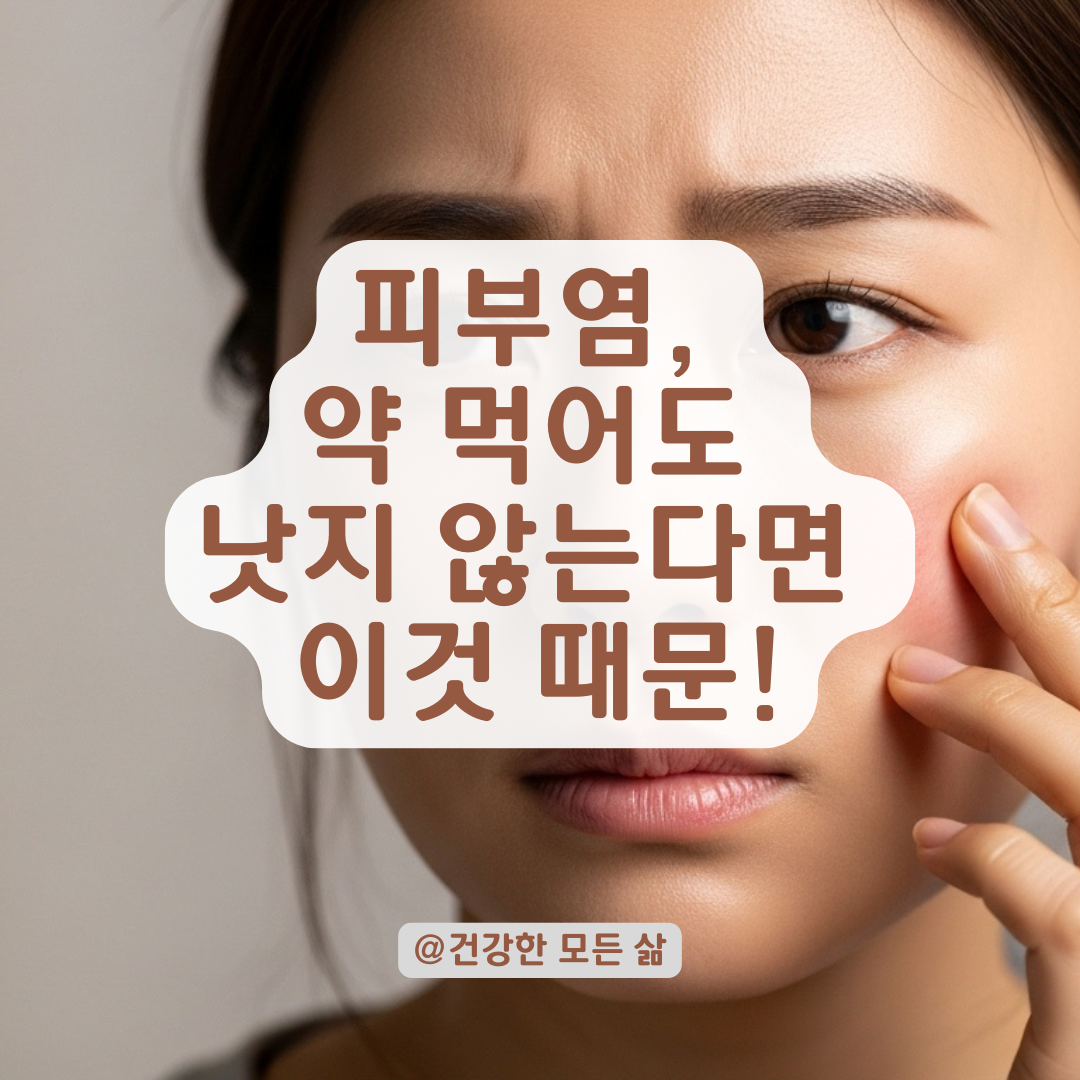 스테로이드·항생제 치료에도 효과 없는 피부염, 다른 질환일 수 있습니다.