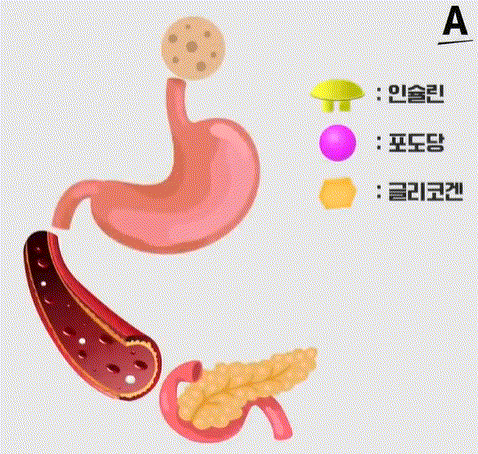 혈당