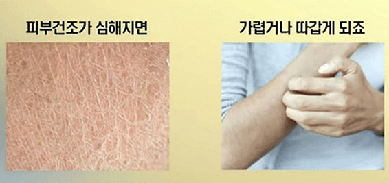 피부건조증과가려움을나타내는손과팔-알파리놀렌산효능
