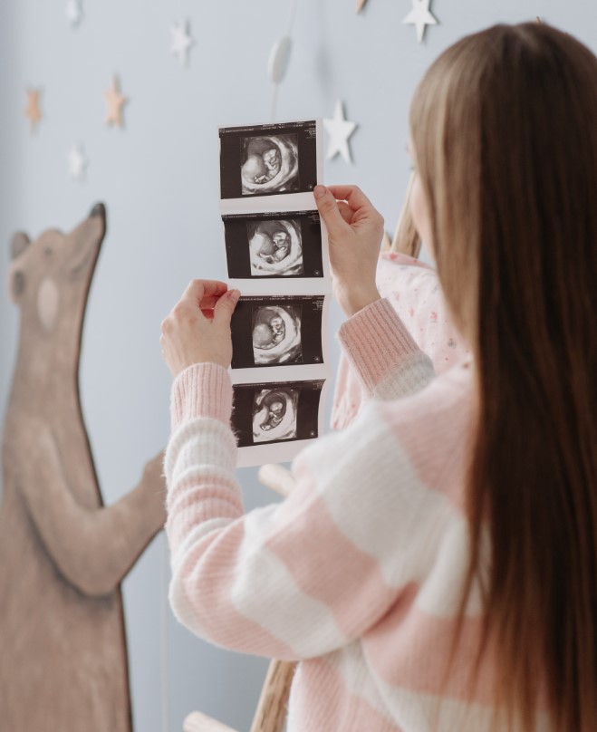 임산부 초콜릿 섭취량