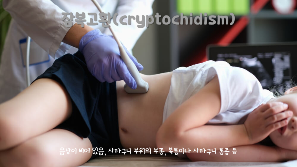 잠복고환(cryptochidism)
잠복고환 주요 증상 : 음낭이 비어 있음, 사타구니 부위의 부종, 복통이나 사타구니 통증 등