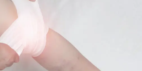 수두 증상 18