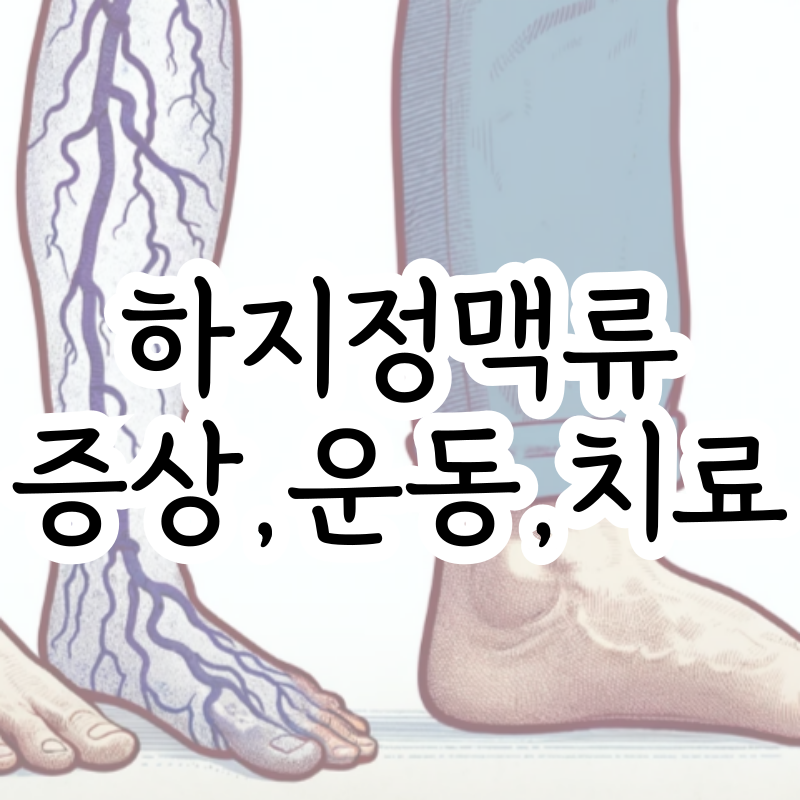 하지정맥류 초기 증상 운동 병원 수술 썸네일