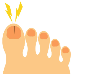 손톱에 세로줄이 들어가는 주된 원인손톱에 세로줄이 들어가는 주된 원인